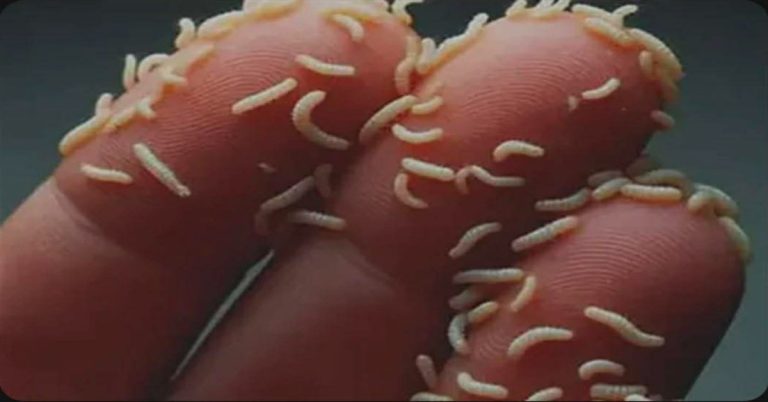 Čaj protiv parazita Parazol